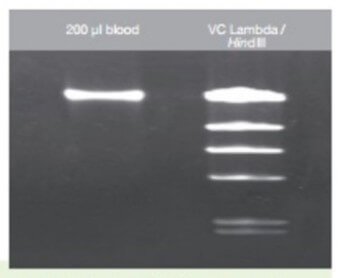 KIT DE PURIFICACION DE DNA 100Pbas